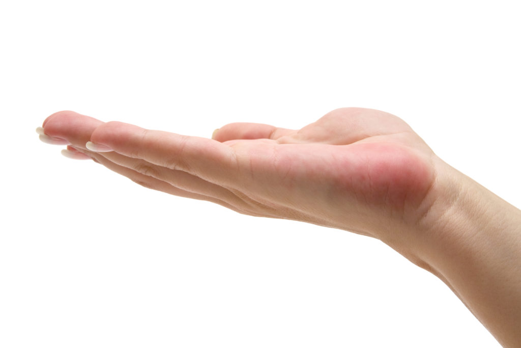 How to Treat & Manage Hand Burns