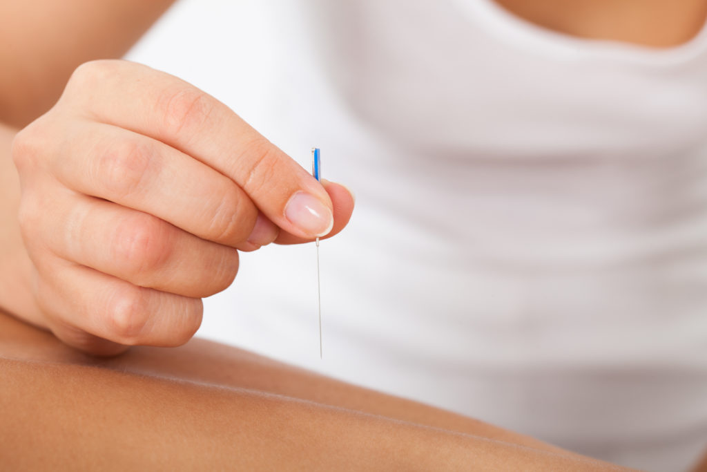 What the Heck is Dry Needling?